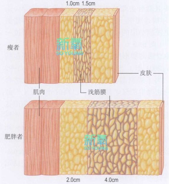 其实胖的人和瘦的人皮下组织中的肌肉部分以及浅层脂肪组织的厚度是