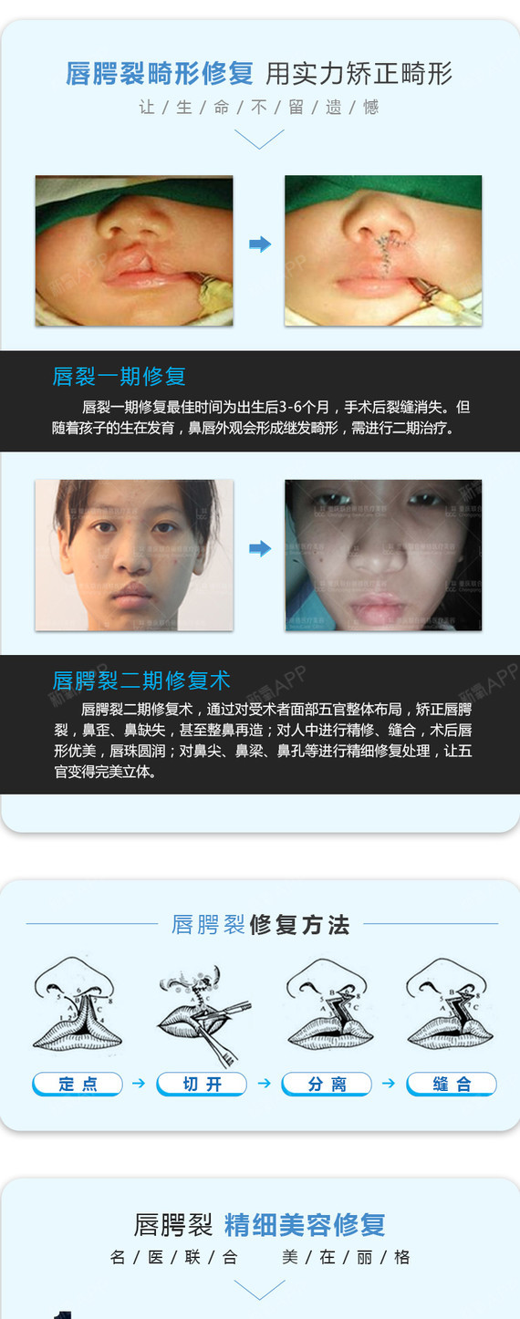 【唇腭裂手术】兔唇修复 唇裂修复 副主任医师主刀 唇