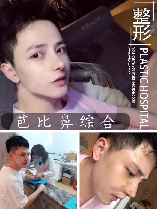 男士整形需注意什么呢?