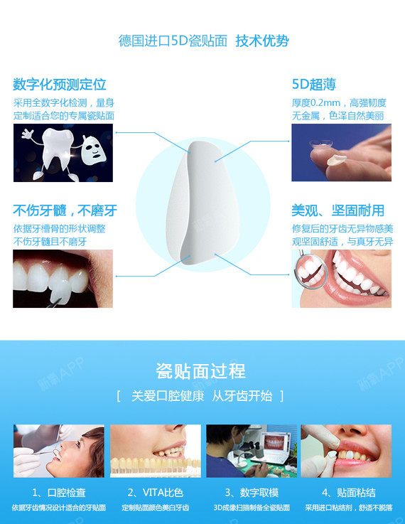 【瓷贴面】5d纳米晶瓷贴面|德国进口晶瓷|坚固美观,晶莹剔透,快速修复