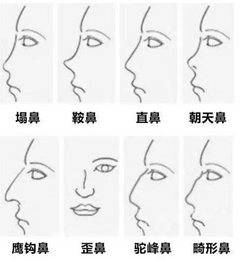 长沙健丽科普常见的几种鼻部形态