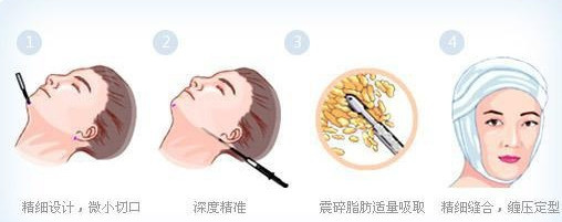 随着经济和科技的发展,越来越多的朋友们摒弃