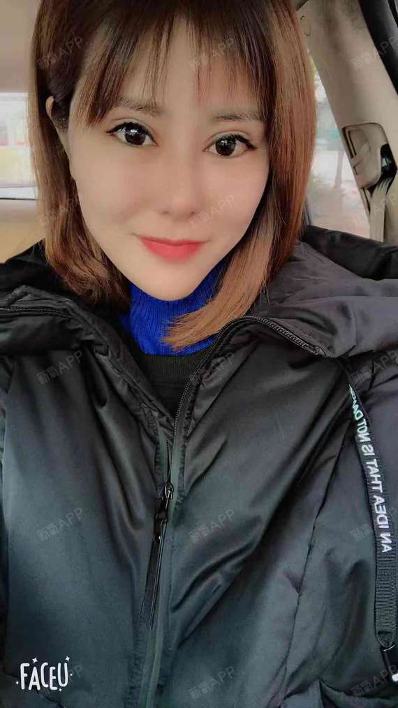 氧气znng1眼部综合第45天美丽日记-新氧美容整