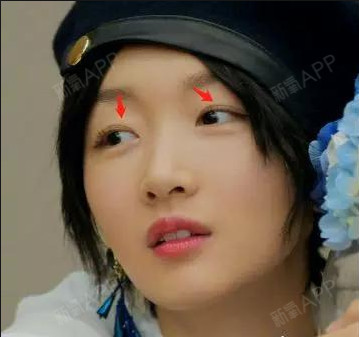周冬雨居然割了双眼皮?