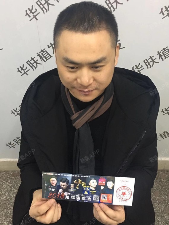 继续分享我们大重庆的优秀青年创作歌手——华伦大咖的植发经历哦