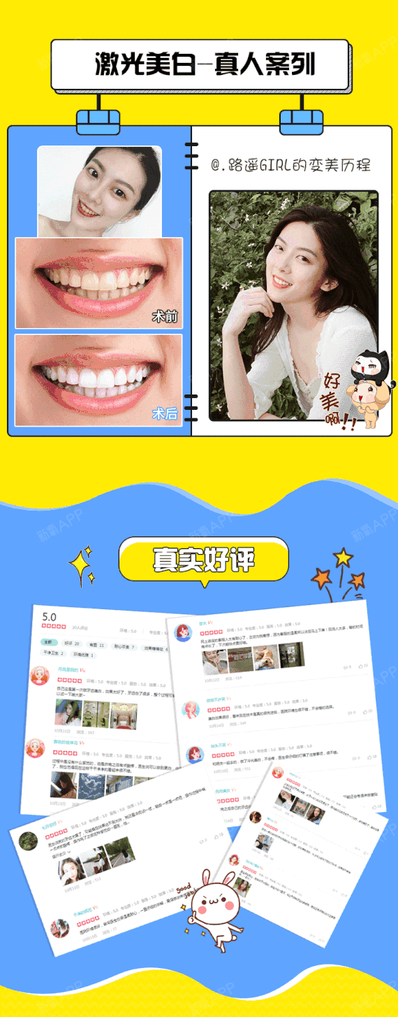 【冷光美白】牙齿美白 进口仪器舒适无敏 不伤牙齿激光美白牙齿 适合