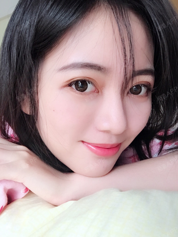 术后第125天