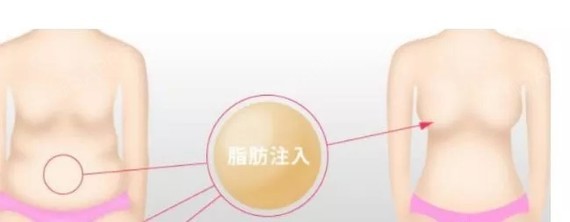 当好处圈都被颜美、高瘦、胸大刷爆之后,对于apk的瘦身朋友图片