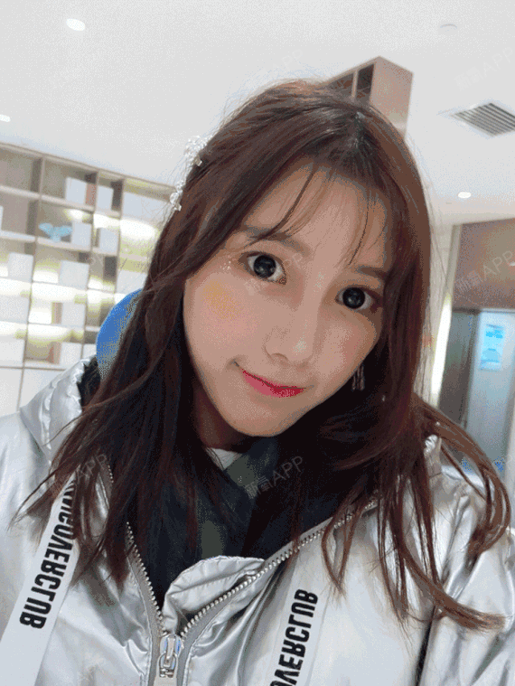 新氧- 爱吃爆米花 | 自体脂肪填充全脸 | 术后当自强 | 重庆同城