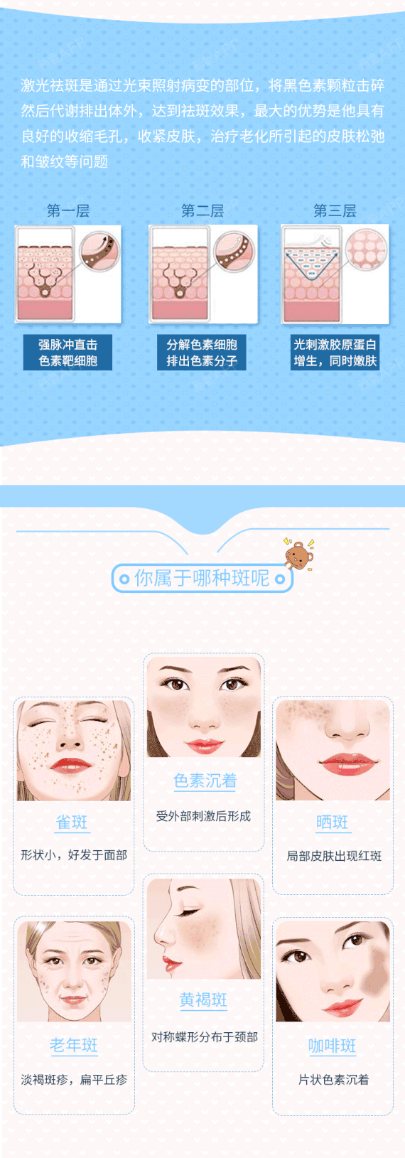 【激光祛斑】【美国m22】祛红血丝,祛痘印,美白嫩肤,解决各种色斑问题