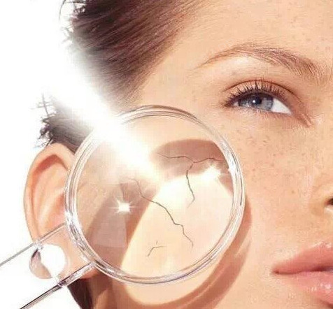 闭合性粉刺形成原因痘痘、痤疮、粉刺、疖肿、