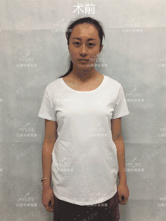 云南华美美莱美容医院美丽日记