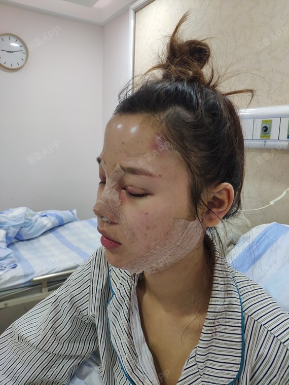 杨杨杨爱爱姑娘美容第6天美视频记-新氧综合整技巧丽日与女生眼部图片