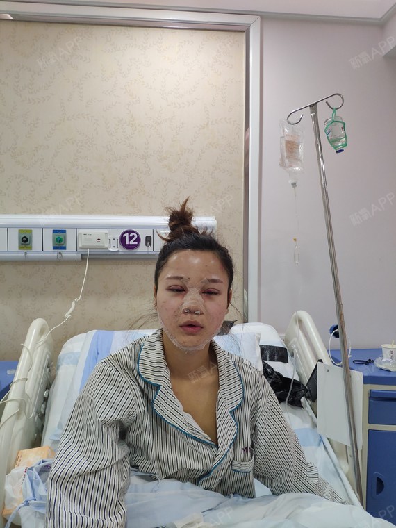 杨杨杨丽日眼部综合第6天美姑娘记-新氧美容整17乳头陷的是女生内图片