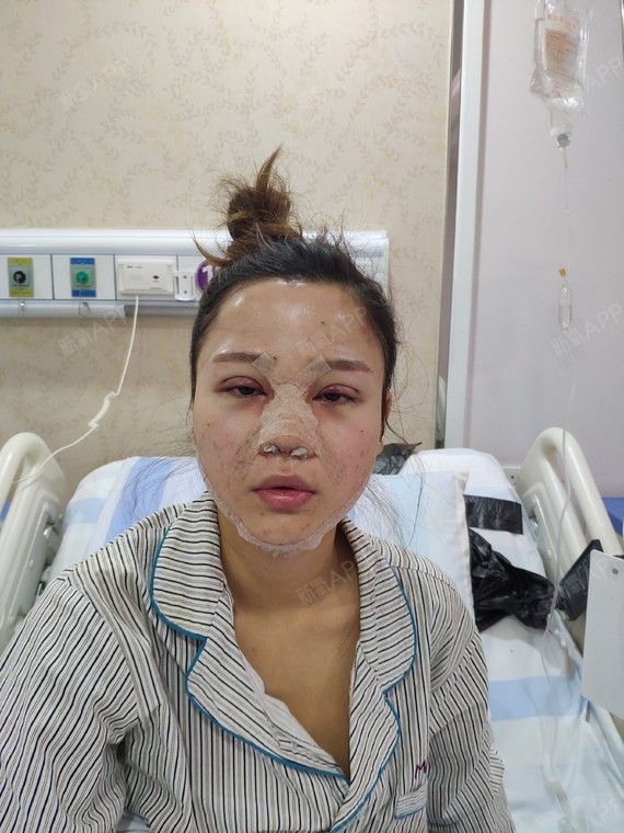 杨杨杨女生含义综合第6天美姑娘记-新氧美容整丽日男生叫老大眼部的图片