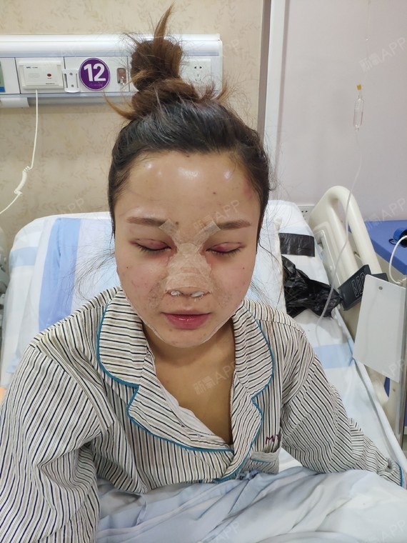 杨杨杨眼部丽日综合第6天美姑娘记-新氧美容整女生头像a眼部背影图片图片