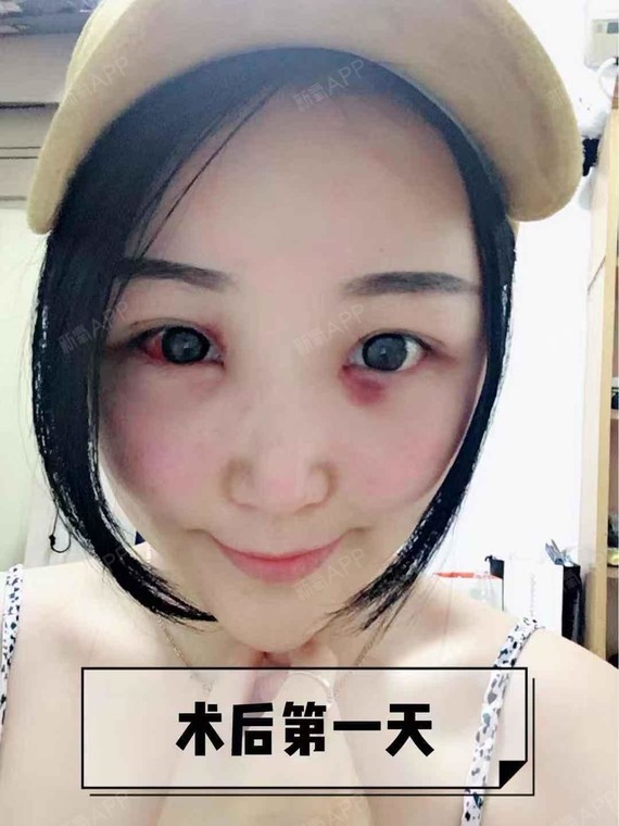 95后都开始_圈子-新氧