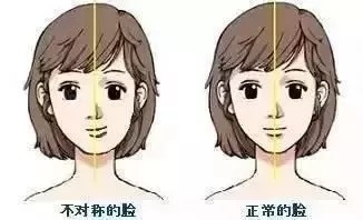 这5种牙齿矫正后,脸型变化最大!1、地包天-易形
