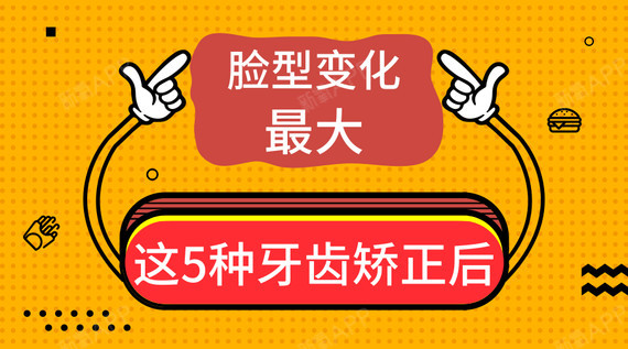 这5种牙齿矫正后,脸型变化最大!1、地包天-易形