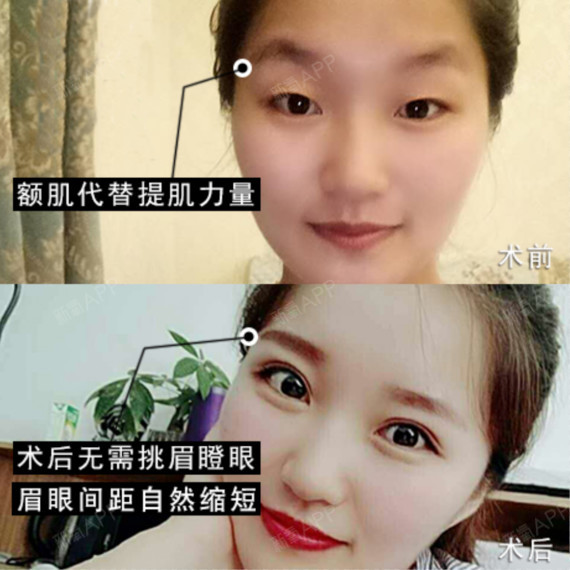 93因为提肌无力的小仙女化好美美的妆,自拍或者做什么表情时都会不