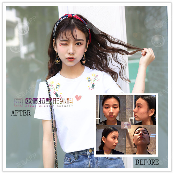 【欧佩拉轮廓8件套限时9折秒杀】-免费接送机