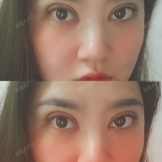 很多女孩子双眼