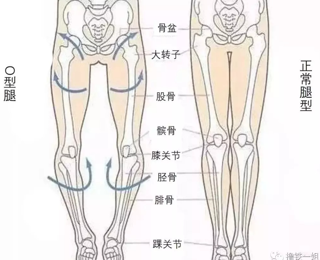 如何改善x型/o型腿?