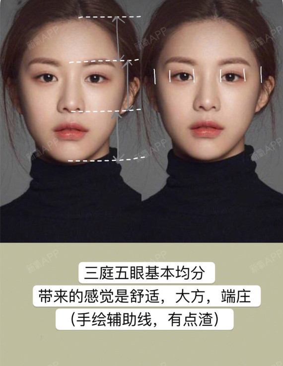 韩国最新整容模板出炉,"蛇精脸"时代终于结束