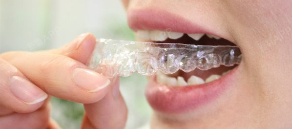 昆明柏德口腔:儿童做牙齿矫正的最佳时机!在乳