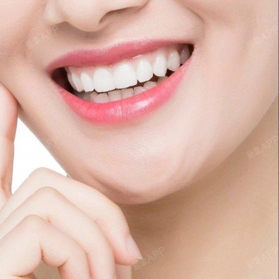 硬核科普:冷光美白牙齿了解一下