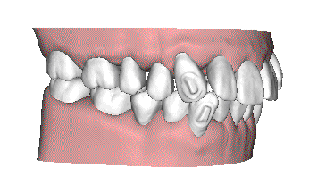 小苏告诉你『啥是[:62]佩奇[:62]』这两天,一只粉红色