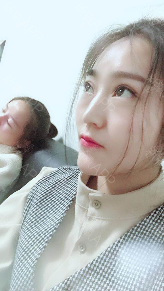 与你素手挽清风面部吸脂第36天美丽日记-新氧