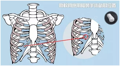 现在软肋都长鼻子上?