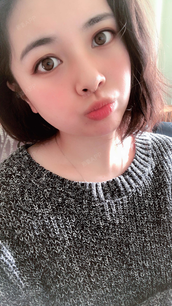 天津华亦俏医疗美容鼻综合第13天美丽日记-新