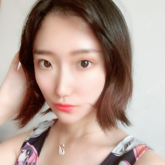 么么哒么么么么么哒自体脂肪全脸填充第124天