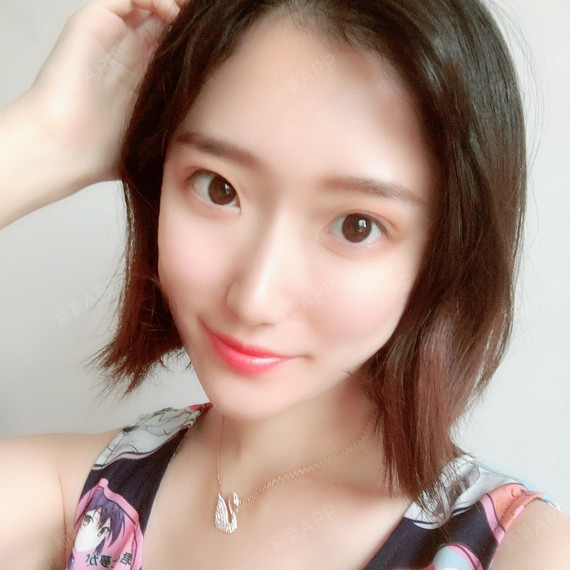 么么哒么么么么么哒自体脂肪全脸填充第124天