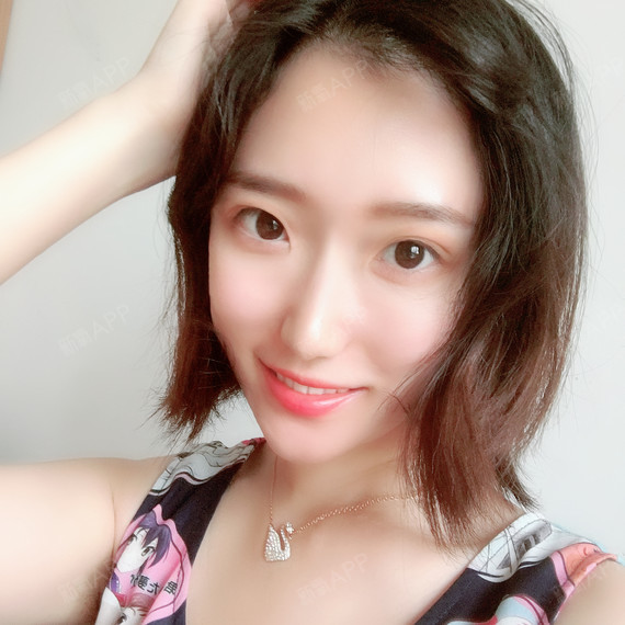 么么哒么么么么么哒自体脂肪全脸填充第124天