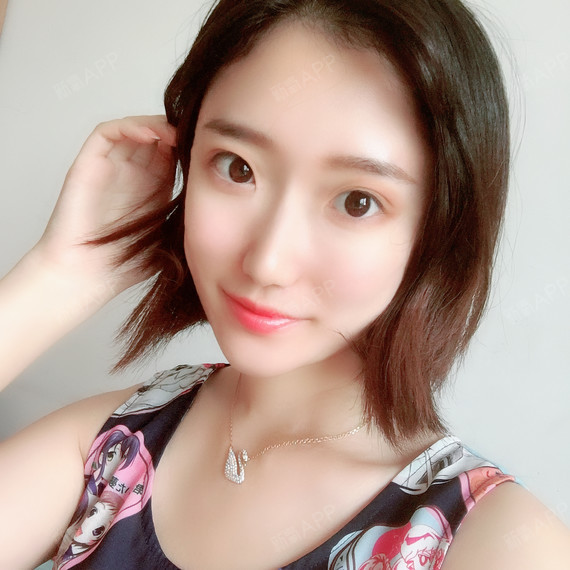 么么哒么么么么么哒自体脂肪全脸填充第124天