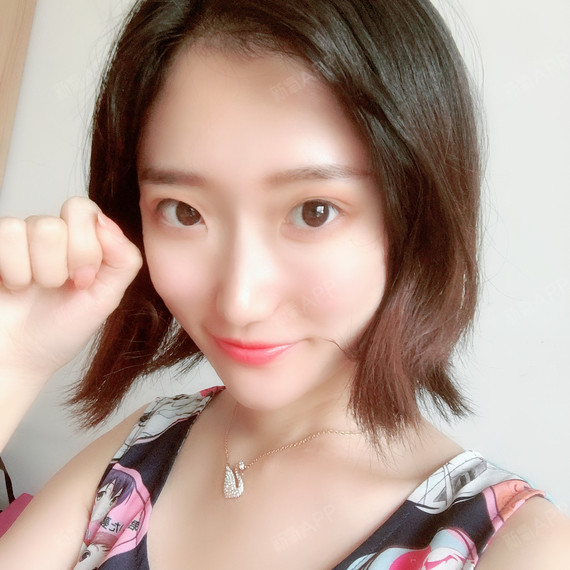 么么哒么么么么么哒自体脂肪全脸填充第124天