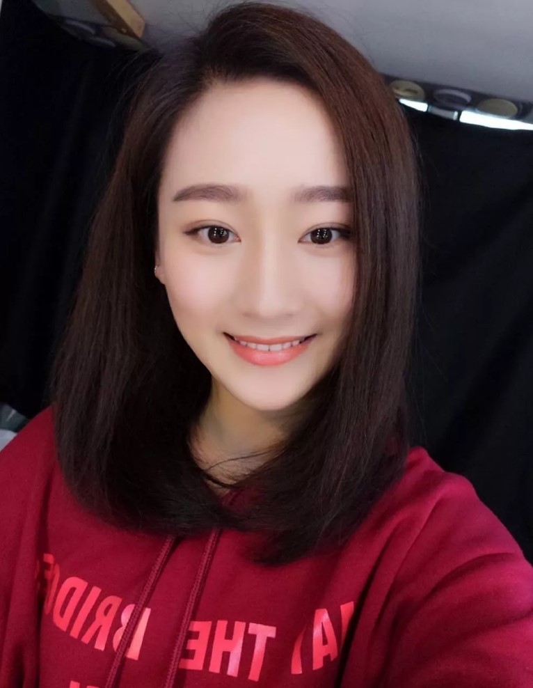 v-line瓜子脸手术怎么样_恢复过程_效果如何_小奶猫12