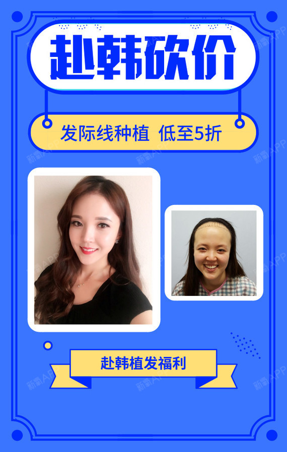 期:毛杰林-5福利网红发际线体验团[:153]发友