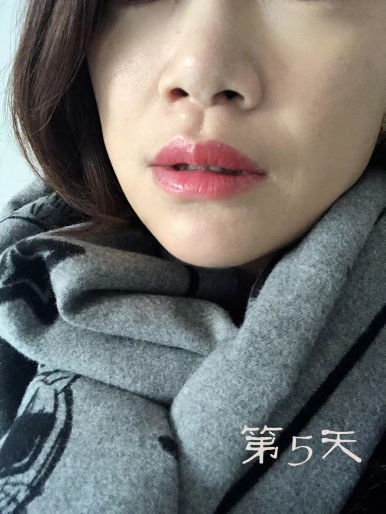 半永久纹唇第8天