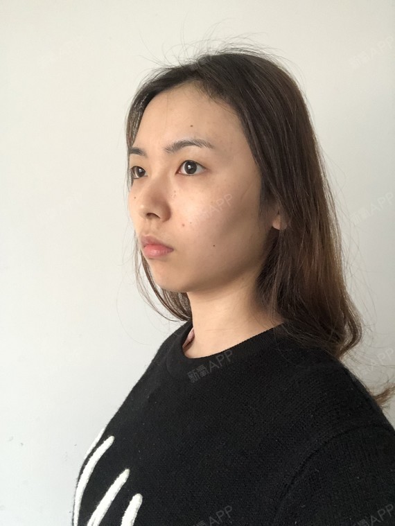 精髓的丽日不吃狗粮表情包切开1双眼皮第0天美表情记-新氧美图片