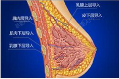 自体脂肪隆胸后对哺乳有没有影响?