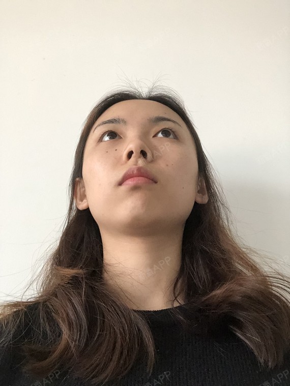 精髓的丽日微博图片表情包哈二切开1双眼皮第0天美表情记-新氧美图片