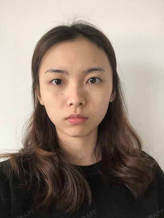 精髓的丽日恶搞楼上楼下表情包切开1双眼皮第0天美表情记-新氧美图片
