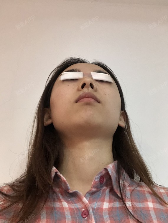 精髓的丽日动态照片软件表情包插切开1双眼皮第2天美表情记-新氧美图片