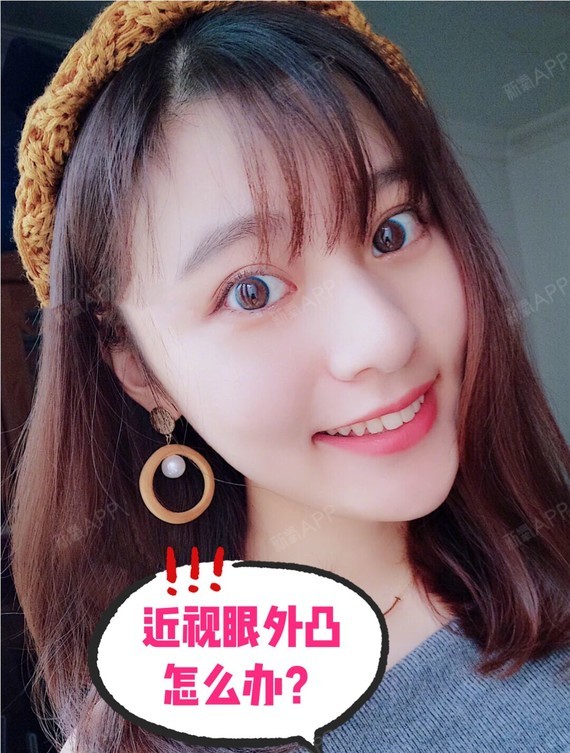 长期戴眼镜会不会导致眼球外凸?