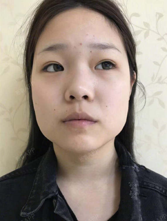 徐斌大大,您能帮我看看,我的大脸应该