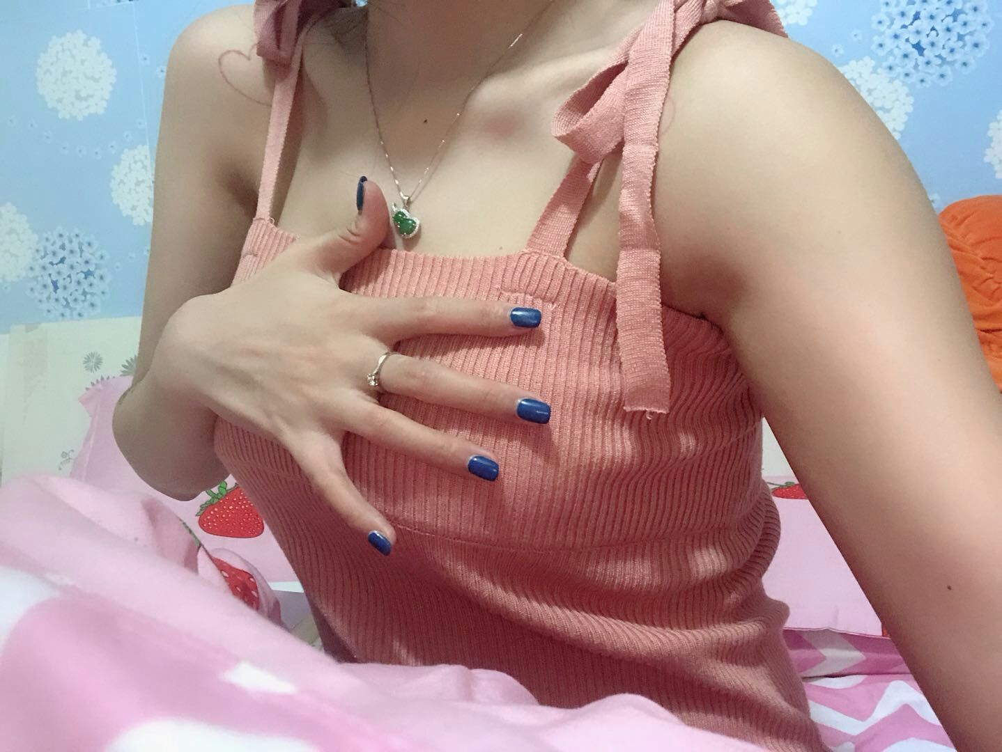 假体隆胸第260天